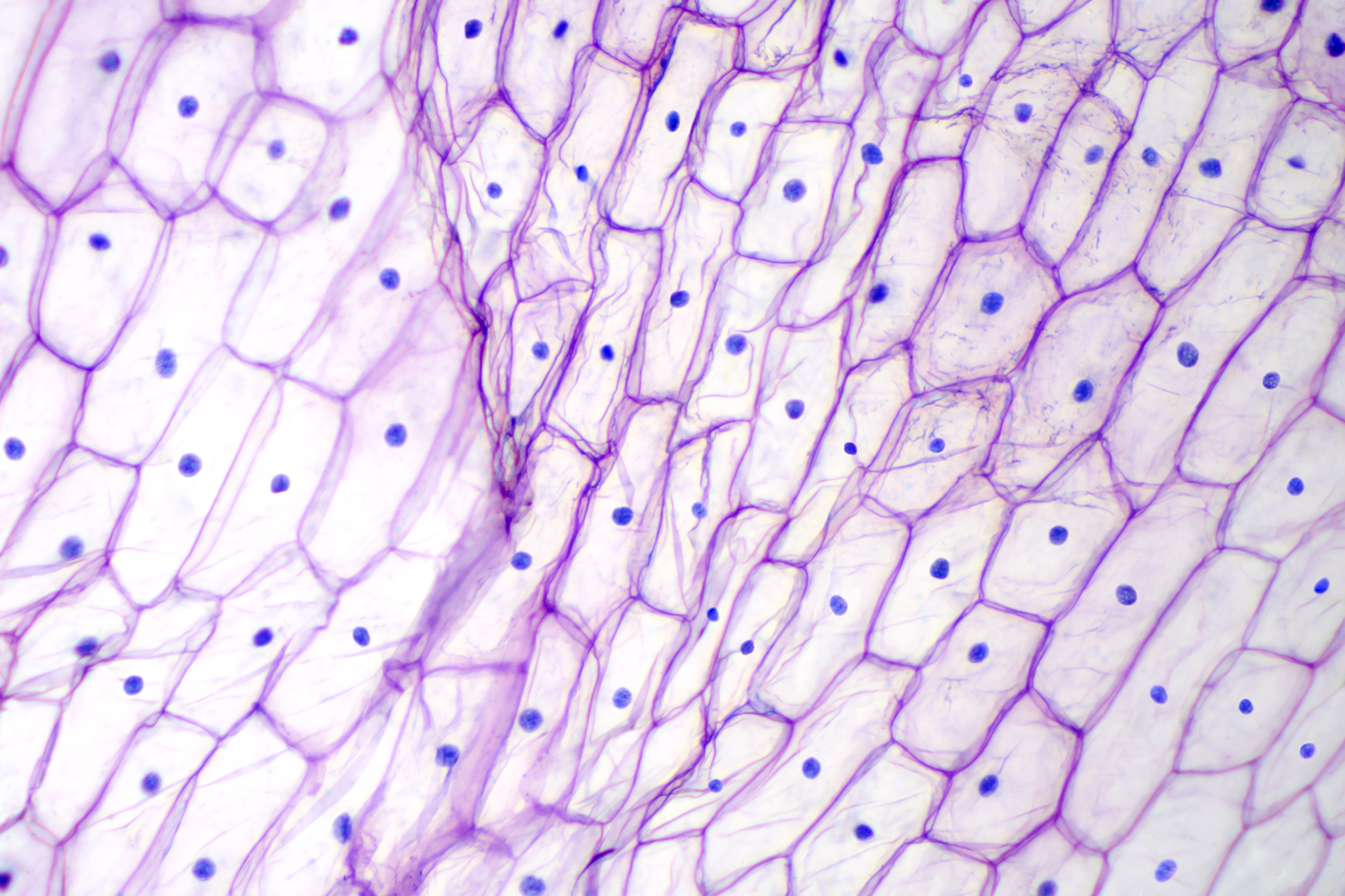 Эпидермис чешуи лука под микроскопом